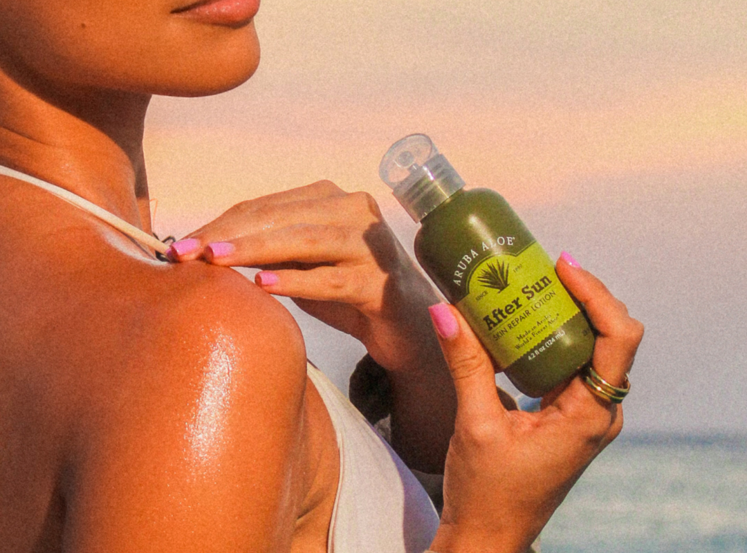 Royal Aruba Aloe After Sun Skin Repair Lotion 