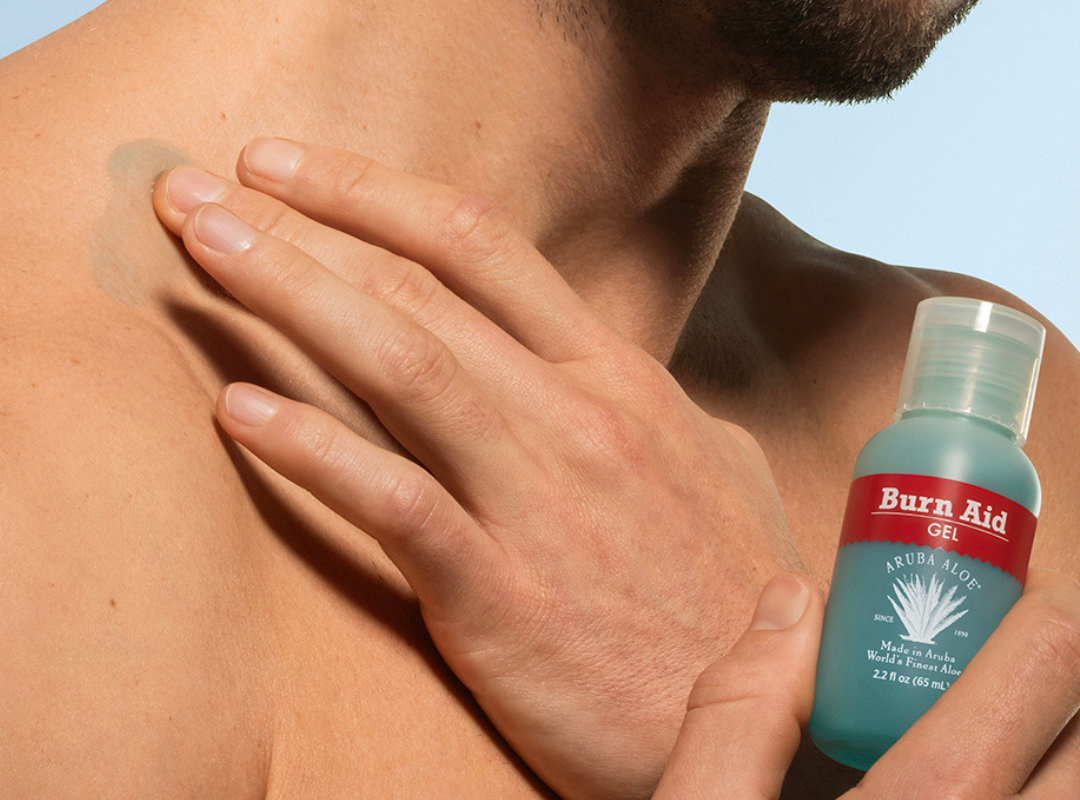 Royal Aruba Aloe Burn Aid Gel 